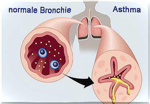 10 foods for asthma