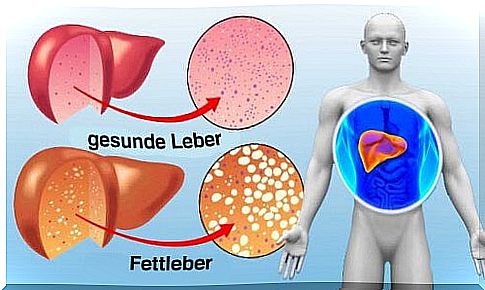 10 foods to cleanse the liver