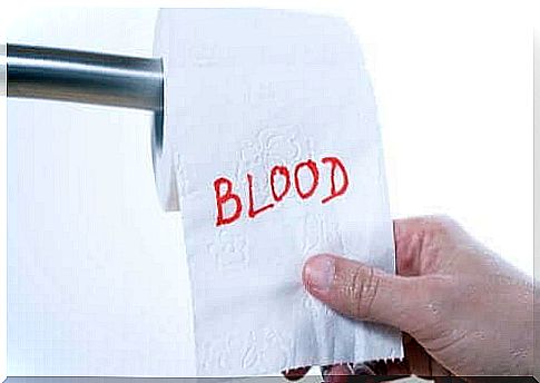 Blood in the stool: possible causes