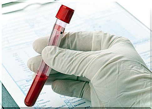 blood sample