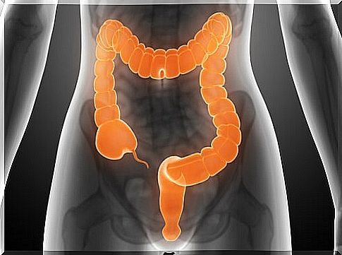 Healthy intestinal lining: why it's so important