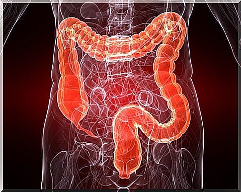 Colitis 