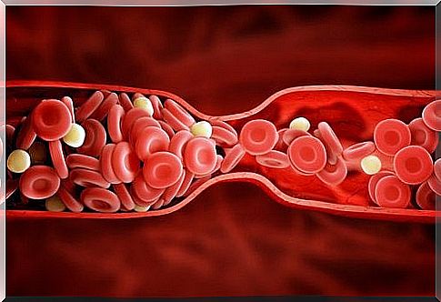 New highly effective treatment for bad cholesterol