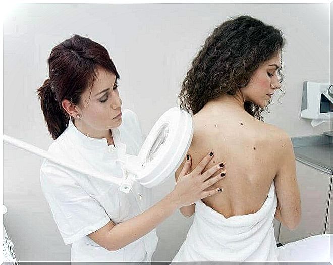 Female doctor examines red birthmarks