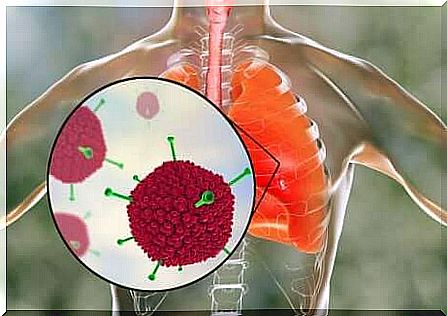 Severe acute respiratory syndrome: causes 