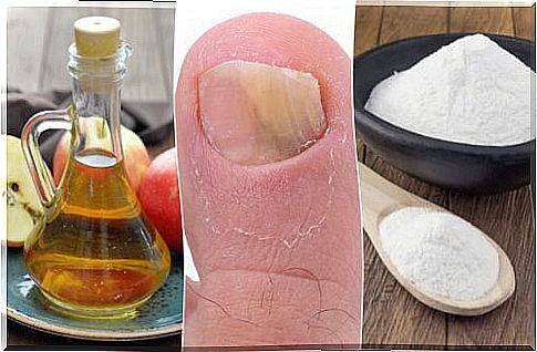 Treat nail fungus naturally with apple cider vinegar and baking soda